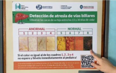 Curso sobre pesquisa de colestasis neonatal en el hospital Materno Infantil