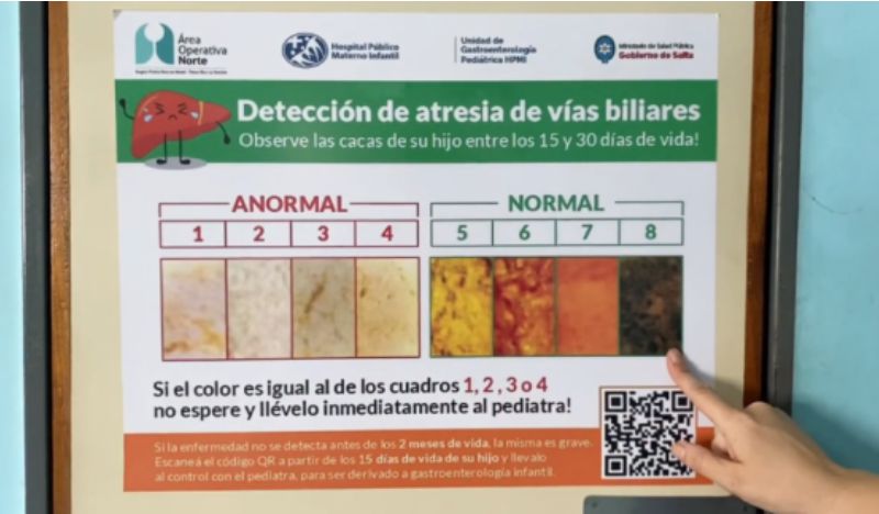 Curso sobre pesquisa de colestasis neonatal en el hospital Materno Infantil